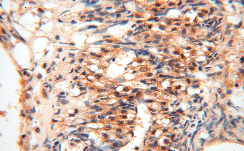Immunohistochemical of paraffin-embedded human ovary using Catalog No:107990(AMFR antibody) at dilution of 1:100 (under 40x lens)