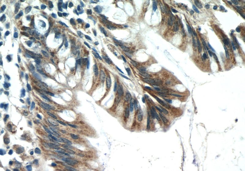 Immunohistochemistry of paraffin-embedded human colon tissue slide using Catalog No:108731(C4orf29 Antibody) at dilution of 1:50 (under 40x lens)