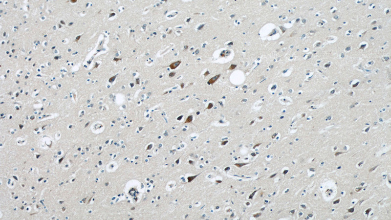 Immunohistochemical of paraffin-embedded human brain using Catalog No:113235(GRIN2B antibody) at dilution of 1:50 (under 10x lens)