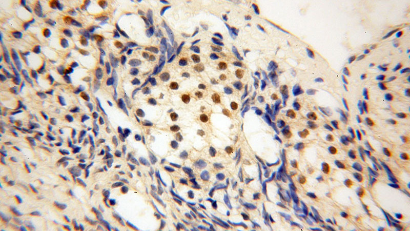 Immunohistochemical of paraffin-embedded human ovary using Catalog No:117226(BRCC3 antibody) at dilution of 1:50 (under 40x lens)