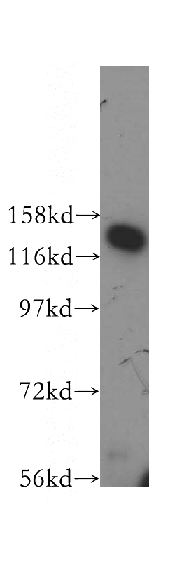 K-562 cells were subjected to SDS PAGE followed by western blot with Catalog No:113166(NFX1 antibody) at dilution of 1:300