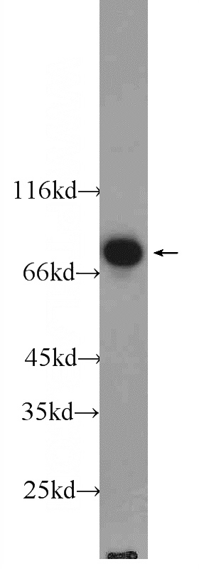 Jurkat cells were subjected to SDS PAGE followed by western blot with Catalog No:110320(ENOX1 antibody) at dilution of 1:1000