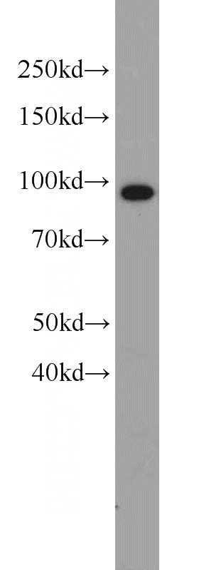 SH-SY5Y cells were subjected to SDS PAGE followed by western blot with Catalog No:116726(VCP antibody) at dilution of 1:1000