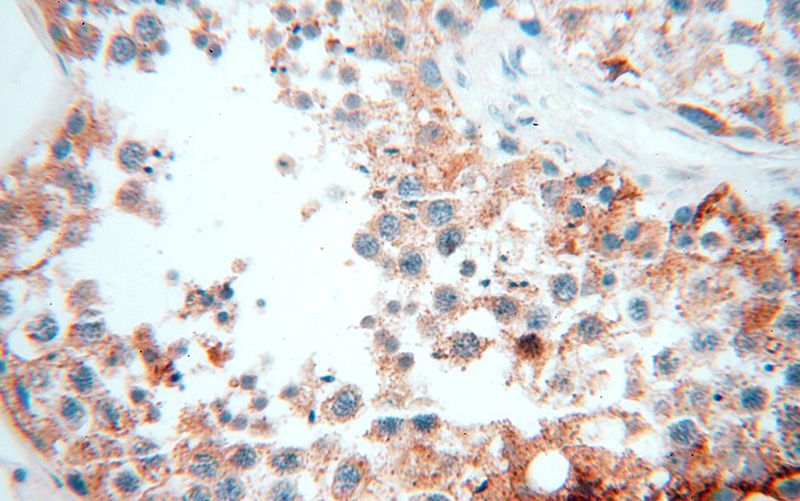 Immunohistochemical of paraffin-embedded human testis using Catalog No:113525(OXCT2 antibody) at dilution of 1:100 (under 40x lens)