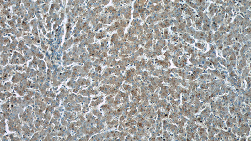Immunohistochemical of paraffin-embedded human liver using Catalog No:115849(TAOK3 antibody) at dilution of 1:50 (under 10x lens)