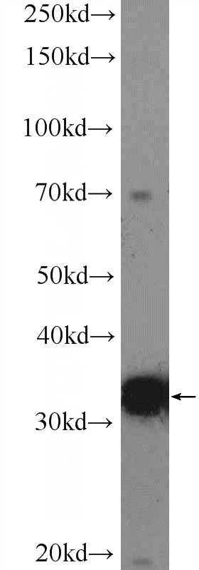 mouse liver tissue were subjected to SDS PAGE followed by western blot with Catalog No:111006(GNMT Antibody) at dilution of 1:600