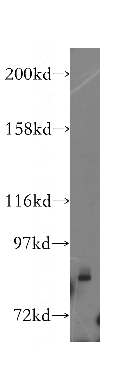 MCF7 cells were subjected to SDS PAGE followed by western blot with Catalog No:109875(DBC1 antibody) at dilution of 1:300