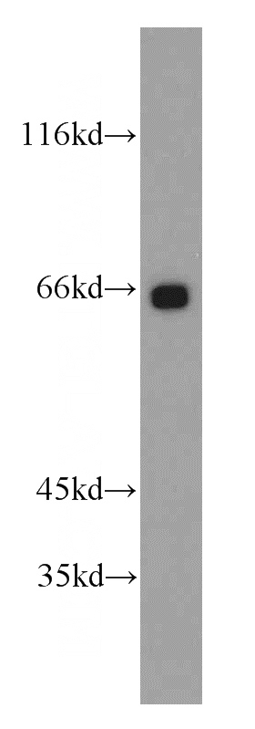 mouse testis tissue were subjected to SDS PAGE followed by western blot with Catalog No:108373(BBS6 antibody) at dilution of 1:600