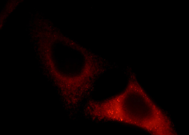 Immunofluorescent analysis of HepG2 cells, using TCIRG1 antibody Catalog No:115910 at 1:25 dilution and Rhodamine-labeled goat anti-rabbit IgG (red).