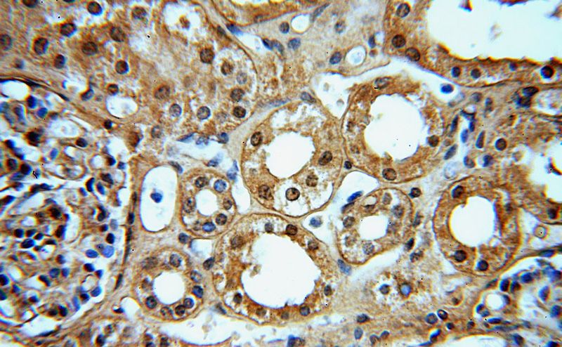 Immunohistochemical of paraffin-embedded human kidney using Catalog No:113909(PNN antibody) at dilution of 1:50 (under 40x lens)