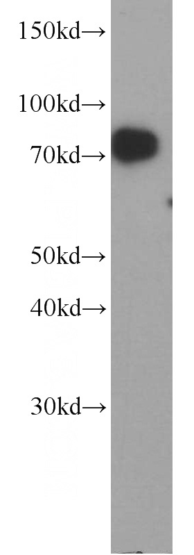 HeLa cells were subjected to SDS PAGE followed by western blot with Catalog No:116144(TNIP1 antibody) at dilution of 1:1000
