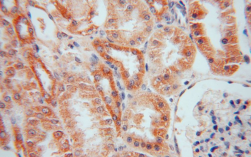 Immunohistochemical of paraffin-embedded human kidney using Catalog No:112411(LYPLAL1 antibody) at dilution of 1:50 (under 40x lens)