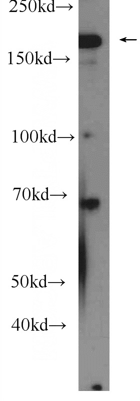 HepG2 cells were subjected to SDS PAGE followed by western blot with Catalog No:111825(IQGAP2 Antibody) at dilution of 1:300