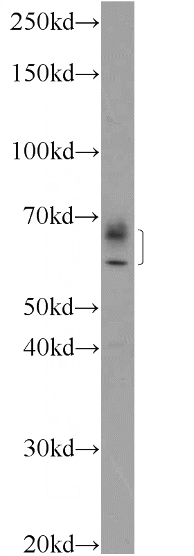 RAW 264.7 cells were subjected to SDS PAGE followed by western blot with Catalog No:111618(IFIT1L Antibody) at dilution of 1:300