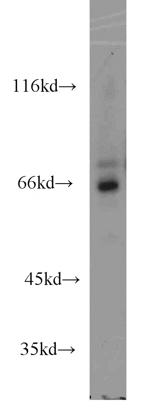mouse brain tissue were subjected to SDS PAGE followed by western blot with Catalog No:107778(ADCK5 antibody) at dilution of 1:800
