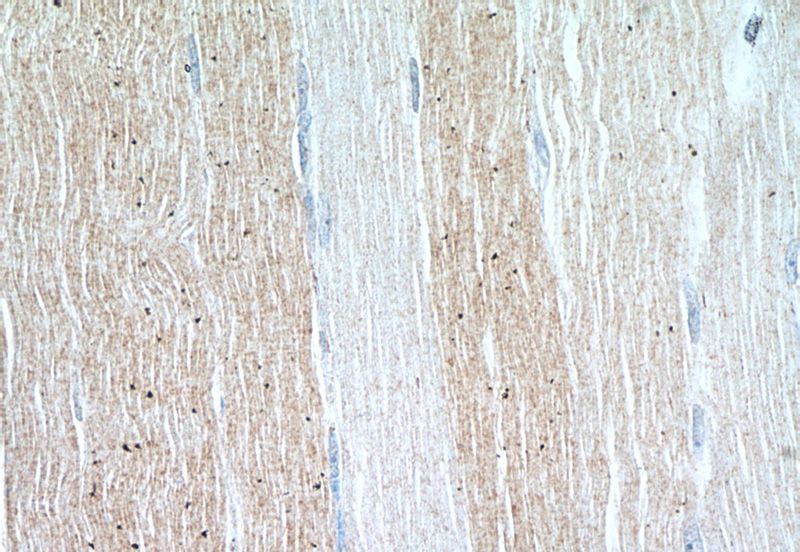 Immunohistochemistry of paraffin-embedded human skeletal muscle tissue slide using Catalog No:111959(ITPKC Antibody) at dilution of 1:50 (under 40x lens)