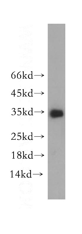 SH-SY5Y cells were subjected to SDS PAGE followed by western blot with Catalog No:113133(NTF3 antibody) at dilution of 1:1000
