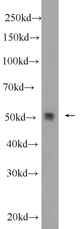 mouse brain tissue were subjected to SDS PAGE followed by western blot with Catalog No:114104(PPP2R3C Antibody) at dilution of 1:600