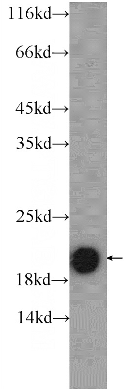 mouse cerebellum tissue were subjected to SDS PAGE followed by western blot with Catalog No:116185(TMEM35 Antibody) at dilution of 1:600