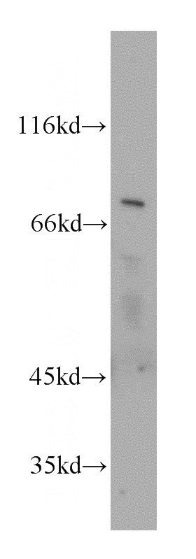 HepG2 cells were subjected to SDS PAGE followed by western blot with Catalog No:115371(SLC37A2 antibody) at dilution of 1:600