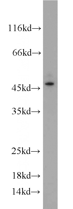 A375 cells were subjected to SDS PAGE followed by western blot with Catalog No:111901(KLK1 antibody) at dilution of 1:500