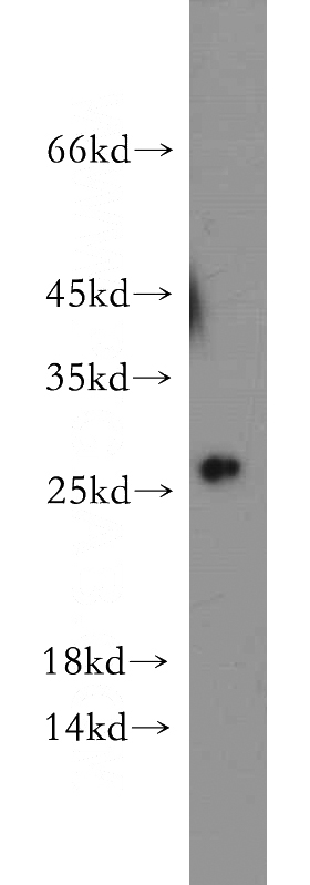 HEK-293 cells were subjected to SDS PAGE followed by western blot with Catalog No:108678(C1orf50 antibody) at dilution of 1:300