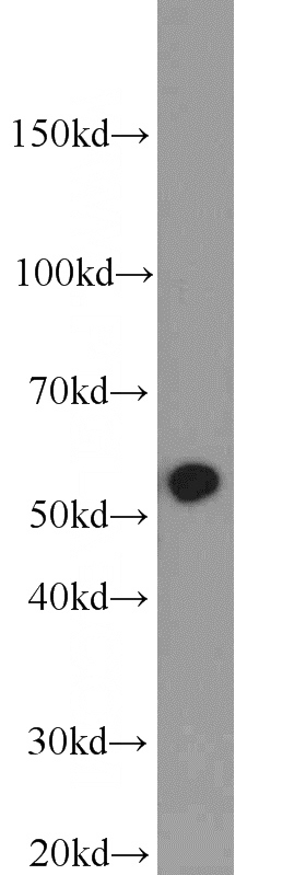 mouse lung tissue were subjected to SDS PAGE followed by western blot with Catalog No:111711(HTR3A antibody) at dilution of 1:800