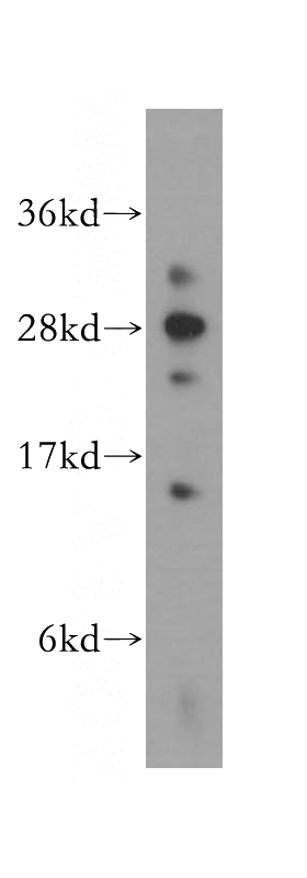 HeLa cells were subjected to SDS PAGE followed by western blot with Catalog No:109949(DNAJC4 antibody) at dilution of 1:1000