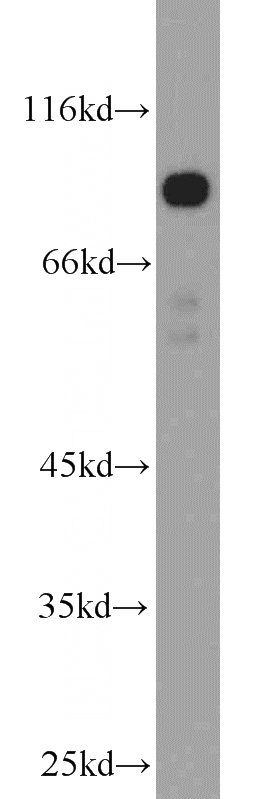 mouse brain tissue were subjected to SDS PAGE followed by western blot with Catalog No:116325(TRIM9 antibody) at dilution of 1:1000