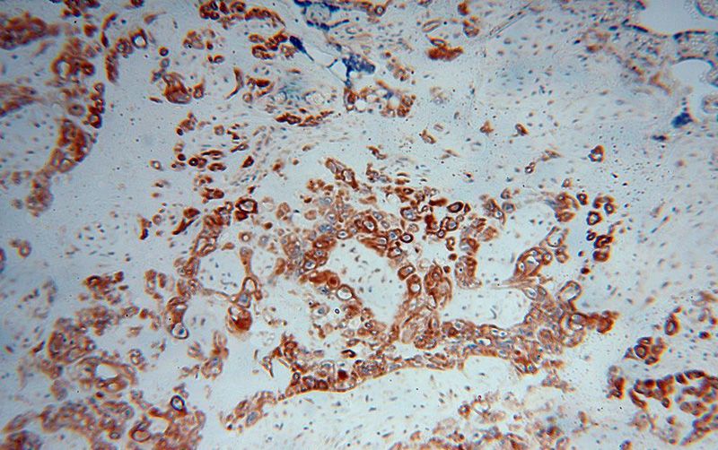 Immunohistochemical of paraffin-embedded human placenta using Catalog No:112726(MSN antibody) at dilution of 1:50 (under 10x lens)