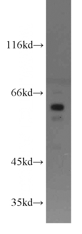 MCF7 cells were subjected to SDS PAGE followed by western blot with Catalog No:113635(PDPK1 antibody) at dilution of 1:1000
