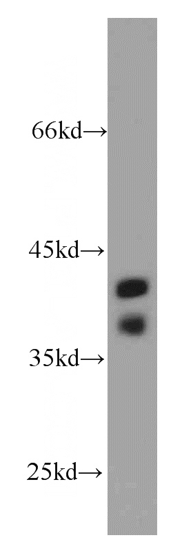 human testis tissue were subjected to SDS PAGE followed by western blot with Catalog No:116367(TSPY3 antibody) at dilution of 1:2000
