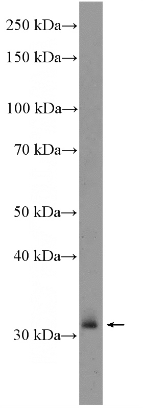 rat spleen tissue were subjected to SDS PAGE followed by western blot with Catalog No:116981(XBP1 Antibody) at dilution of 1:300