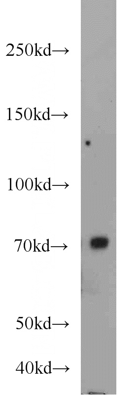 mouse testis tissue were subjected to SDS PAGE followed by western blot with Catalog No:116660(UBQLN3 antibody) at dilution of 1:2000