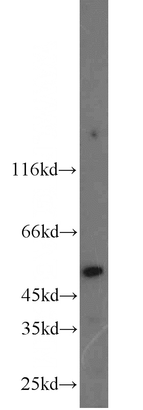 A2780 cells were subjected to SDS PAGE followed by western blot with Catalog No:113868(PI16 antibody) at dilution of 1:200