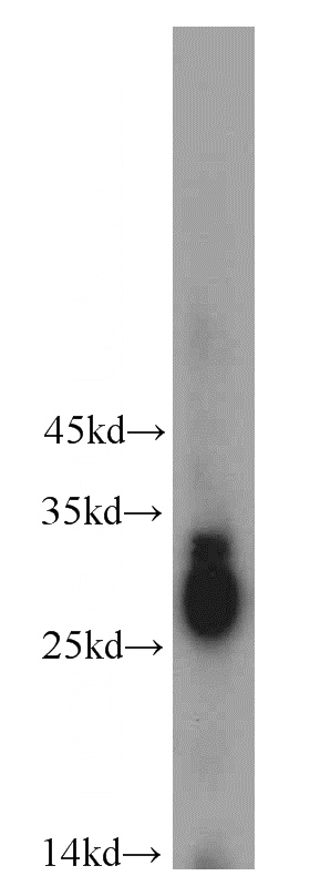 mouse eye tissue were subjected to SDS PAGE followed by western blot with Catalog No:109585(CRYBB3 antibody) at dilution of 1:500