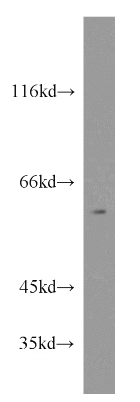 NIH/3T3 cells were subjected to SDS PAGE followed by western blot with Catalog No:114947(RXRB antibody) at dilution of 1:500