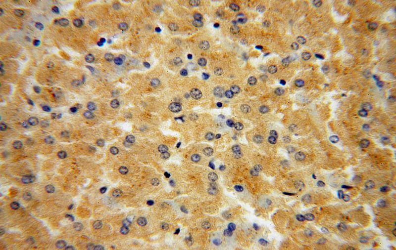 Immunohistochemical of paraffin-embedded human liver using Catalog No:109602(CSNK1G1 antibody) at dilution of 1:100 (under 40x lens)
