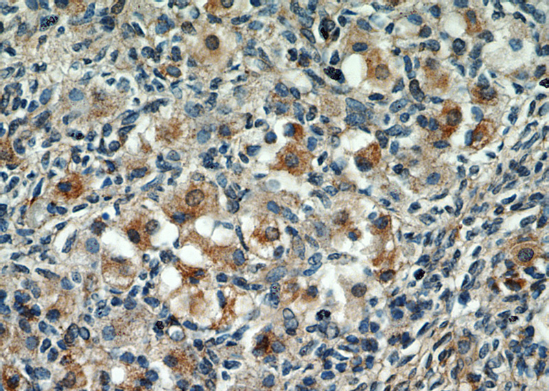 Immunohistochemical of paraffin-embedded human ovary using Catalog No:110295(ECM2 antibody) at dilution of 1:50 (under 40x lens)