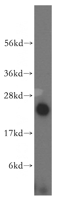 HepG2 cells were subjected to SDS PAGE followed by western blot with Catalog No:113070(NDUFB10 antibody) at dilution of 1:500