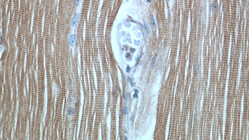 Immunohistochemical of paraffin-embedded human skeletal muscle using Catalog No:116151(TNNI1 antibody) at dilution of 1:50 (under 40x lens)