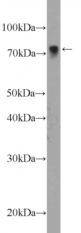 NIH/3T3 cells were subjected to SDS PAGE followed by western blot with Catalog No:112229(LIMK2 Antibody) at dilution of 1:600