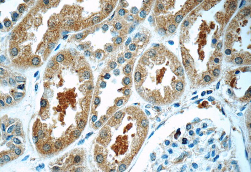 Immunohistochemistry of paraffin-embedded human kidney tissue slide using Catalog No:116448(TXNDC16 Antibody) at dilution of 1:50 (under 40x lens)