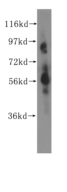mouse thymus tissue were subjected to SDS PAGE followed by western blot with Catalog No:109281(CHRNA6 antibody) at dilution of 1:500