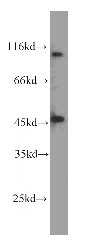 HeLa cells were subjected to SDS PAGE followed by western blot with Catalog No:107637(TTF1-Specific antibody) at dilution of 1:2000