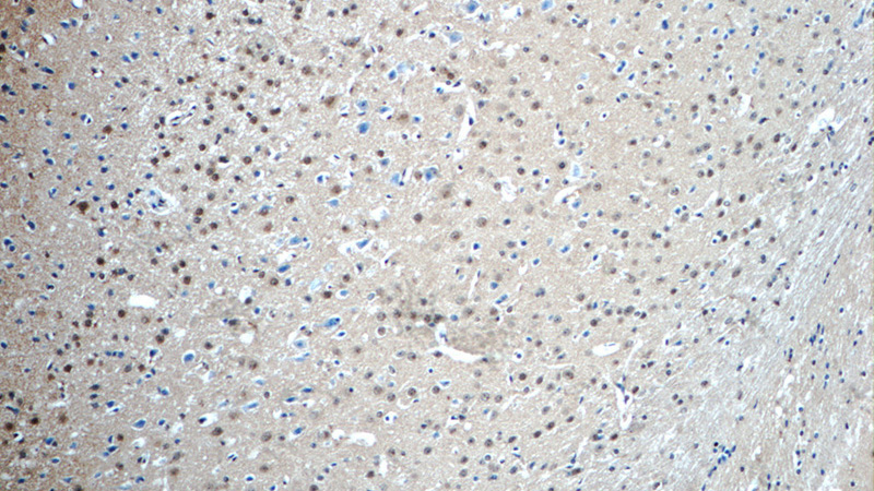 Immunohistochemistry of paraffin-embedded mouse brain tissue slide using Catalog No:113116(NET1 Antibody) at dilution of 1:50 (under 10x lens)