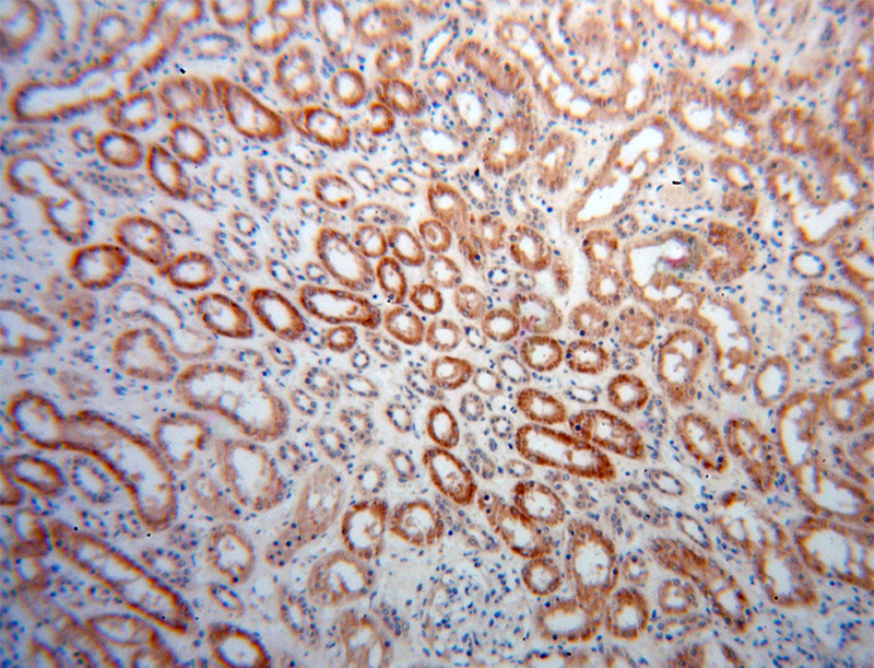Immunohistochemical of paraffin-embedded human kidney using Catalog No:113864(PHYH antibody) at dilution of 1:50 (under 10x lens)