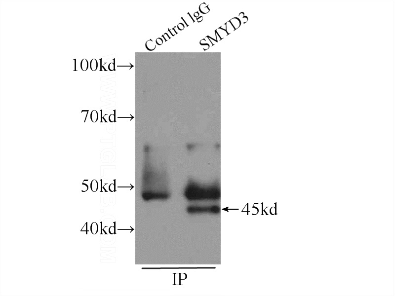 IP Result of anti-SMYD3 (IP:Catalog No:115408, 4ug; Detection:Catalog No:115408 1:500) with COLO 320 cells lysate 1280ug.