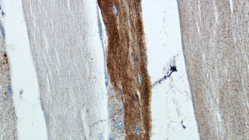 Immunohistochemistry of paraffin-embedded human skeletal muscle tissue slide using Catalog No:112445(MARCH5 Antibody) at dilution of 1:50 (under 40x lens)