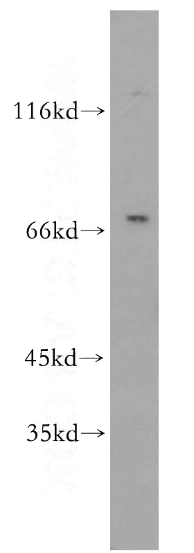 HL-60 cells were subjected to SDS PAGE followed by western blot with Catalog No:114860(RTKN2 antibody) at dilution of 1:800